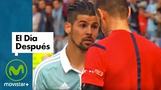 El Día Después 26102015 Nolito se Topa con Keylor [upl. by Vivienne881]