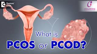 What is PCOS or PCOD  Dr Bandita Sinha of Cloudnine Hospitals  Doctors Circle [upl. by Ycnahc974]