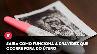 Gravidez fora do útero tem sintomas semelhantes à gestação normal saiba o tratamento [upl. by Eenahs62]