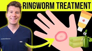 Doctor explains HOW TO TREAT RINGWORM jock itchathletes foot  Medications plus natural remedies [upl. by Clerc]