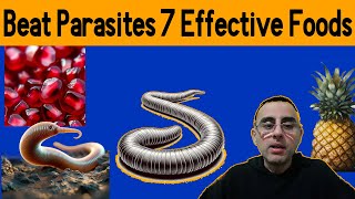 Top 7 food against Parasitic infection [upl. by Swanson]