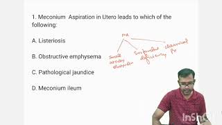 Neonatology MCQTopic 1 MECONIUM ASPIRATION SYNDROME mcq newborn education neet [upl. by Nolyarb220]