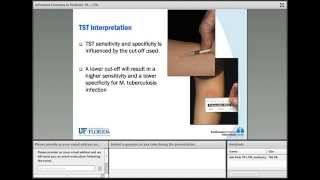 Advanced Concepts in Pediatric TB Latent TB Infection [upl. by Pentheam636]