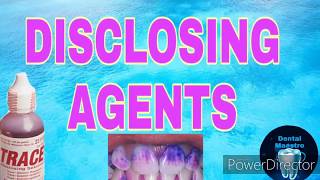 Disclosing Agents  plaque disclosing agent  properties  method of use  Dental Maestro [upl. by Polash]