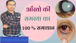 Homeopathic medicine Cineraria Maritima For eye problems vision defectsमोतियाबिंद जड़ से ख़त्म [upl. by Aerdno608]