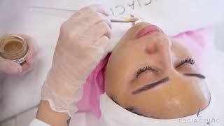 Experience flawless skin with Dermamelan at Lucia Clinic [upl. by Magen]