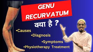 Genu recurvatum in Hindi  Causes  Diagnosis  Medical Treatment  Physiotherapy Treatment [upl. by Ecyaj]