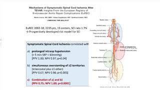 EACTA Vascular Webinar 3 Routine CSF Drainage CON Balthasar Eberle [upl. by Cha289]