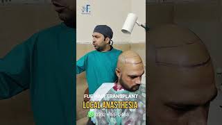 Local Anasthesia For FUE HAIR TRANSPLANTDr Faisal Hayat KhanBest Hair Transplant Clinic [upl. by Nomyaw75]