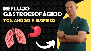 Cuando la Tos y el Ahogo Esconden Reflujo Gastroesofágico [upl. by Nerin]