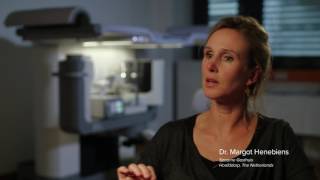 Affirm Prone Breast Biopsy System Testimonial Dr Henebiens [upl. by Nihcas]