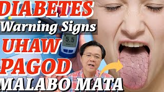 Diabetes Warning Signs Uhaw Pagod Malabo Mata  Payo ni Doc Willie Ong 259b [upl. by Nimrac474]