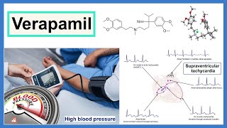 verapamil [upl. by Eiramanad]