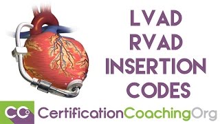 Review of LVAD RVAD Insertion Codes  Medical Coding Training [upl. by Atterbury536]