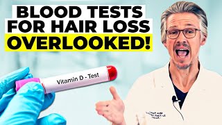 BLOOD TESTS FOR HAIR LOSS THE CRITICAL BLOOD TESTS YOU NEED NOW [upl. by Aihsinat]