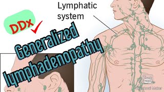 Approach to Diagnosing Generalized Lymphadenopathy [upl. by Ardnuasal]