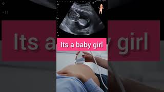 Ultrasound at 12 weeks of pregnancy babygirl ytshorts [upl. by Aylatan]