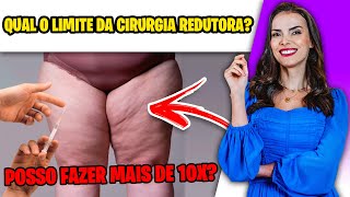 DESCUBRA O LIMITE DA CIRURGIA REDUTORA DE LIPEDEMA [upl. by Asinet506]