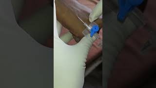 How to insert iv cannula in vein  cannulation technique medical short [upl. by Lyrrad]