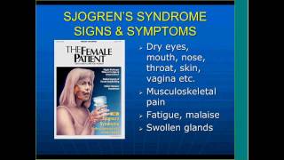 Sjogrens Syndrome Beyond Dry Eyes and Mouth by Frederick Vivino MD [upl. by Libys23]