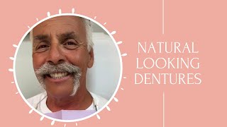 Making Dentures Look natural [upl. by Hickey]