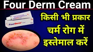 Four Derm Cream Uses in Hindi  Skin Infection Solution  पूरे जानकारी हिंदी  Full Review [upl. by Scherle99]