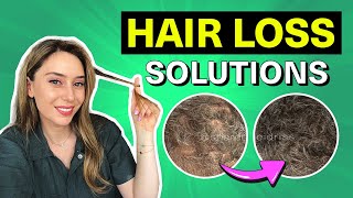 ONION JUICE FOR EXTREME HAIR GROWTH Stop Hair loss amp Grow Long Hair [upl. by Sadira]