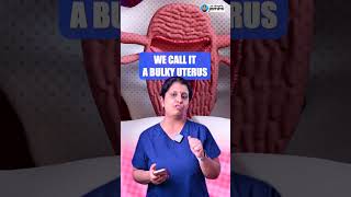 What You Need To Know About Adenomyosis  Dr Deepthi Jammi [upl. by Inal]