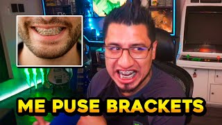 Fedelobo Habla de sus BRACKETS en los Dientes [upl. by Enilrac]