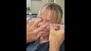 How to Properly Tape an Eyelid Closed [upl. by Lynelle]