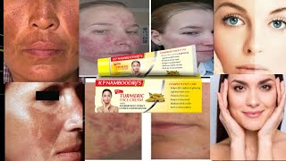 Kp namboodiris turmeric fairness cream  Kp namboodiris turmeric fairness cream review  😱😱 [upl. by Wilfreda332]