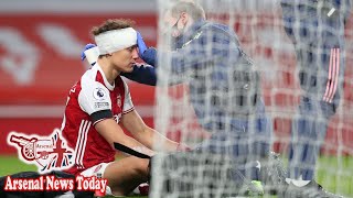 David Luiz and Raul Jimenez in sickening clash of heads during Arsenal vs Wolves clash  news today [upl. by Vento462]