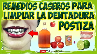 Como limpiar la dentadura postiza de forma casera  remedios caseros [upl. by Nedyrb]