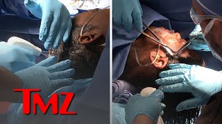 Tessica Brown Gets Gorilla Glue Out of Hair Video of Surgery  TMZ [upl. by Atina]