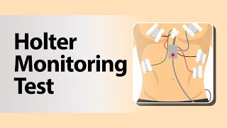 Holter Monitoring Test [upl. by Nahaj]