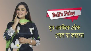 মুখ বাঁকা হয়ে যাওয়া  Bell’s Palsy বা Facial Paralysis Causes Symptoms and Treatment [upl. by Dnob]