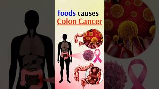 CANCER Causing Foods You Eat Every Day [upl. by Pritchett]