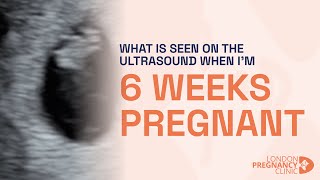 6 Weeks Pregnant Witnessing the First Heartbeat on ultrasound scan [upl. by Gearalt]