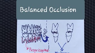 Balanced Occlusion Part 1 [upl. by Akeirahs267]