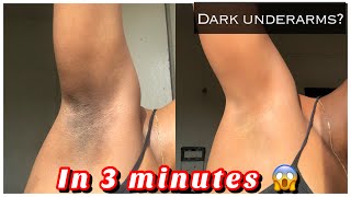 How to Get rid of Dark underarms in 3 minutes instant result [upl. by Damas]