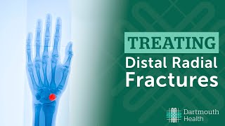 Treating Distal Radius Fractures at Dartmouth Health [upl. by Hanah]