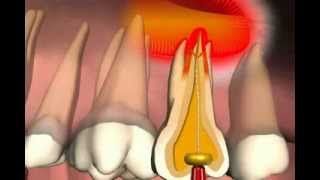 Paranasal Sinuses [upl. by Gorton607]