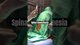 Spinal Anaesthesia anesthesia anesthesiologist anesthesiology shortsfeed ytshorts trending [upl. by Akenor275]