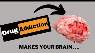 Neuroscientist Explains How Drug Addiction Affects your Brain [upl. by Nylirej]