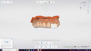 CUD Reference Denture Digital Scans [upl. by Bower]