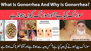 What Is Gonorrhea And Why Is Gonorrhea  Sozak Kia hai Aur Sozak Kyon Hota Hai [upl. by Pilar]