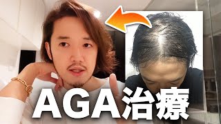 【全ハゲ薄毛男性に送る】AGA治療について本当のことを話そう。 [upl. by Atinal]