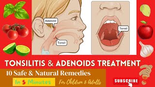 10 Best Effective Proven Home Remedies For Enlarge  Swelling ADENOIDS and TONSILS In Children [upl. by Lovel]