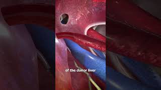 How Liver Transplants Work 🤔shorts shortvideo reels youtubeshorts [upl. by Nare]