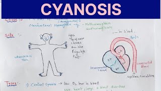 Cyanosis Physiology explained in hindi l Causes l Types l Treatment [upl. by Aker352]